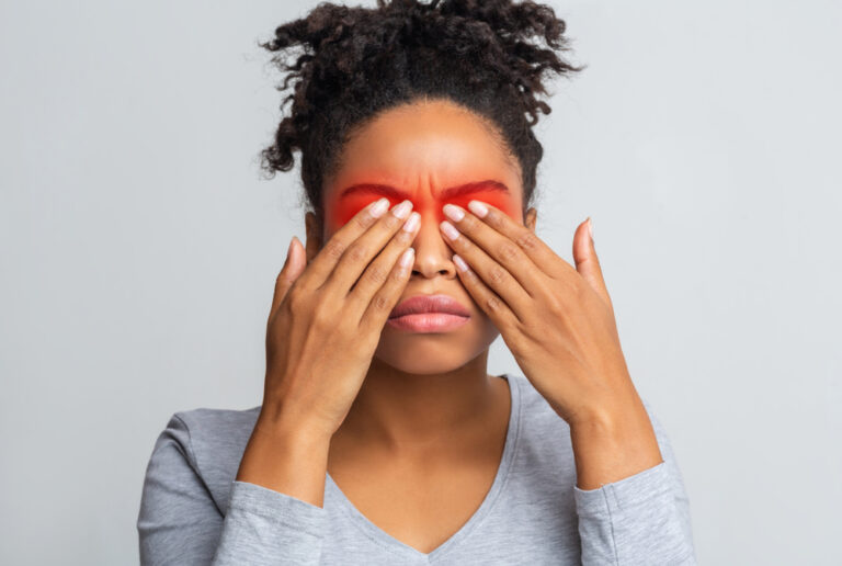 Woman covering irritated red eyes